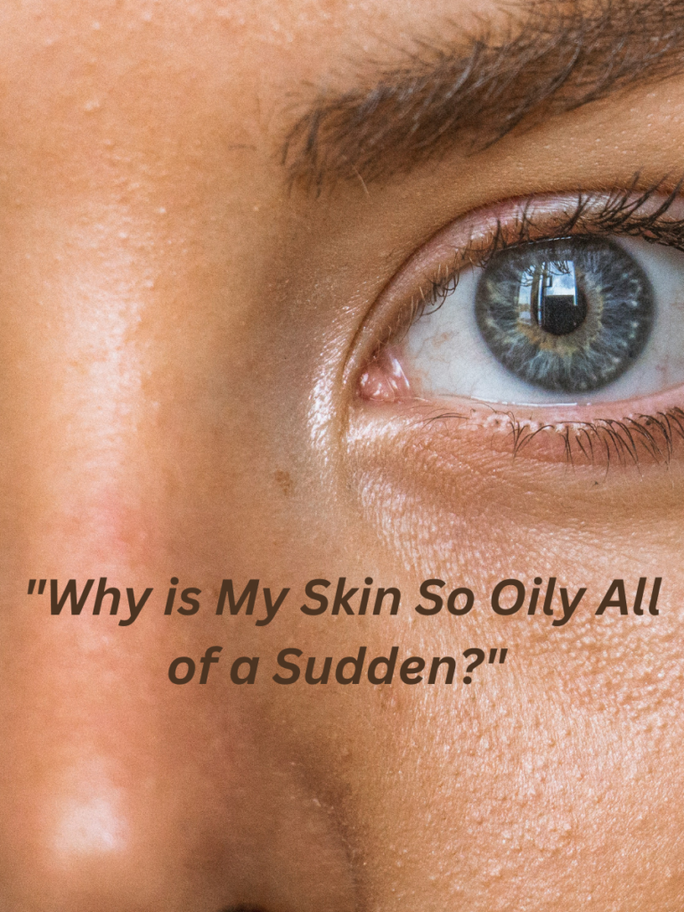"Why is My Skin So Oily All of a Sudden?"